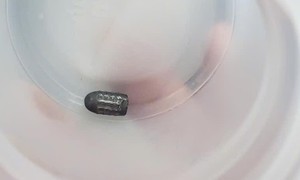 Đã tìm được đối tượng dùng súng hơi bắn chim khiến đạn lạc trúng đầu người phụ nữ đang làm vườn