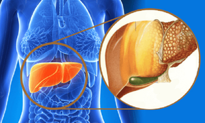 Thêm liệu pháp điều trị virus viêm gan C cấp tính