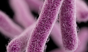 Pháp thu hồi phô mai mềm sau 2 ca tử vong nghi nhiễm khuẩn listeria