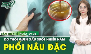 Bản Tin Y Tế 29/8: Phổi đặc với 30 lít dịch đục ngầu do thói quen khó bỏ