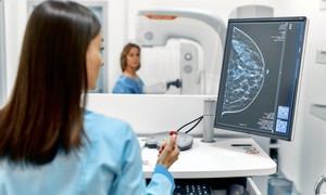 Trí tuệ nhân tạo (AI) giúp phát hiện chính xác ung thư vú