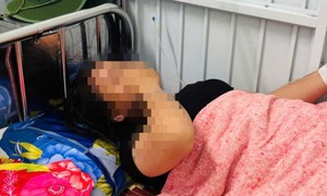 Năm sinh viên nhập viện sau bữa ăn