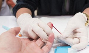 Đa dạng mô hình xét nghiệm HIV: Giải pháp mở rộng tiếp cận nhóm nguy cơ cao