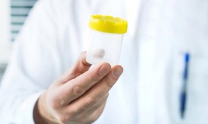 Hormone v&#224; tinh tr&#249;ng nam suy giảm v&#236; bệnh m&#227;n t&#237;nh