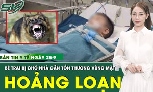 Bản Tin Y Tế 25/9: Bị ch&#243; cắn r&#225;ch v&#249;ng mặt khi đang chơi đ&#249;a, b&#233; trai hoảng loạn, đau đớn