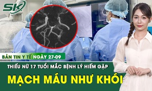 Bản Tin Y Tế 27/9: Mắc hội chứng hiếm, thiếu nữ 17 tuổi c&#243; mạch m&#225;u n&#227;o li ti lan toả như kh&#243;i thuốc