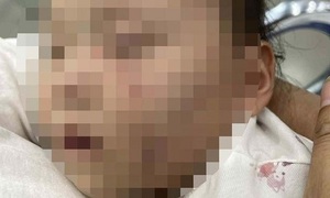 Đón con từ nhà trẻ về có nhiều vết bầm tím trên người: Tạm giữ bảo mẫu để điều tra