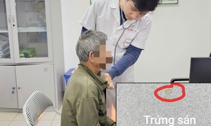 Ổ sán trong đường mật người đàn ông hay ăn đồ tái sống
