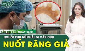 Bản tin Y tế 26/1: Người phụ nữ hoảng hốt khi nuốt phải hàm răng giả