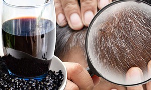 Cách dùng đậu đen chữa bạc tóc sớm đơn giản, dễ làm tại nhà