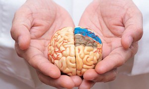 Nguyên nhân phổ biến gây đột quỵ và “thời gian vàng” trong cấp cứu