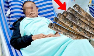 Cả nhà cùng mắc ung thư gan vì thói quen dùng đũa nhiều nhà mắc phải