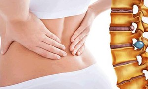 Nguy cơ thoát vị đĩa đệm do ngồi sai cách