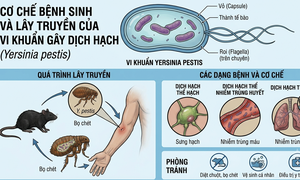 Dịch hạch nguy hiểm thế nào, tại sao chưa tiêm vaccine đại trà?