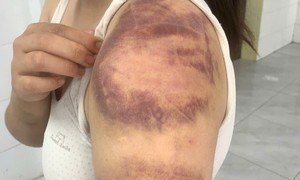 Tạm giữ người đàn ông nhiều lần đánh đập con gái và vợ đang mang thai