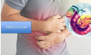 Cảnh giác viêm tụy cấp sau bữa ăn thịnh soạn