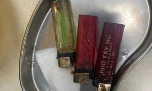 3 chiếc bật lửa trong dạ dày nam thanh niên
