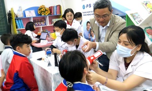 Tỷ lệ sâu răng ở trẻ em Việt Nam chạm mức 90%: Bác sĩ nha khoa khuyên gì?