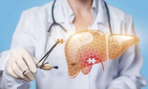 Yếu tố nguy cơ làm tăng tỷ lệ mắc ung thư gan