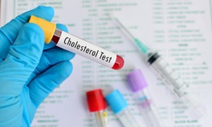 5 cập nhật mới về quản lý cholesterol không cần dùng thuốc