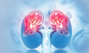 Nhận biết sớm hội chứng thận hư để ngăn ngừa biến chứng nguy hiểm
