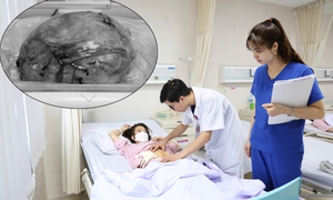 Người phụ nữ có khối u to như thai 7 tháng, nhiều bệnh nguy hiểm