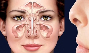Đau hốc mắt kéo dài, coi chừng viêm xoang trán