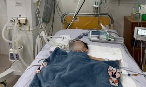 Chạy đua cứu cháu bé 19 tháng tuổi bị suy đa cơ quan do sốc nhiễm khuẩn