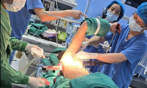 Nạn nhân bị thanh sắt đâm xuyên ngực trên cao tốc Nội Bài - Lào Cai đã được phẫu thuật thành công 