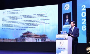 Can thiệp mạch thần kinh Việt Nam đã làm chủ nhiều kỹ thuật khó nhất thế giới