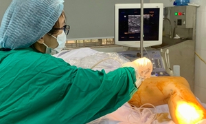 Người cao tuổi đau, tê chân kéo dài… cảnh giác tắc động mạch chi nguy hiểm