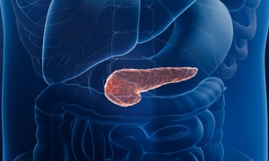 Thử nghiệm lâm sàng thuốc chữa ung thư tụy gây chấn động giới y khoa, giảm nguy cơ tử vong tới 60%
