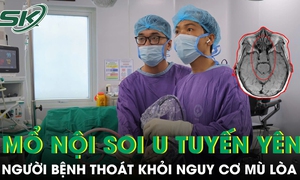 Thoát khỏi nguy cơ mù lòa nhờ phẫu thuật nội soi u tuyến yên 