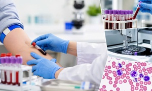 Những xét nghiệm cơ bản ai cũng nên làm