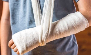 5 dấu hiệu nhận biết gãy xương, những cảnh báo sớm