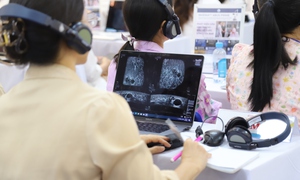 Lần đầu đào tạo siêu âm vú 3D mô phỏng thực tế ảo tại TPHCM, tăng khả năng phát hiện sớm ung thư
