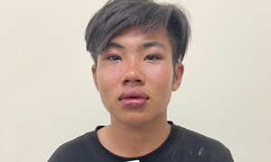 Vừa ra tù đã đâm bạn trọng thương