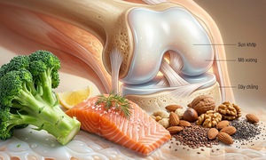 5 loại thực phẩm tốt nhất cho xương khớp khỏe mạnh