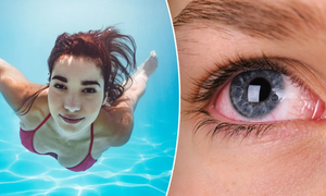 Cách bảo vệ mắt khi đi bơi