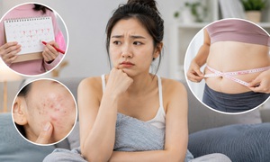 Dấu hiệu buồng trứng đa nang dễ bị bỏ qua