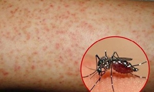 Hơn 1.100 ca mắc sốt xuất huyết, Lâm Đồng kích hoạt các biện pháp phòng, chống dịch