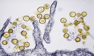 Hantavirus khiến 3 người trên du thuyền MV Hondius tử vong nguy hiểm ra sao?