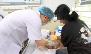 Bé trai 13 tháng phải cắt bỏ tinh hoàn từ dấu hiệu sưng bìu