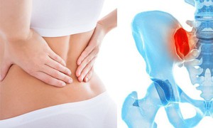 Đau vùng chậu mạn tính do đâu?