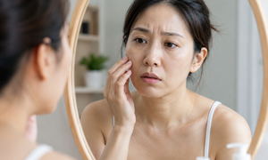 Da chảy xệ sau giảm cân, có nên bổ sung collagen?