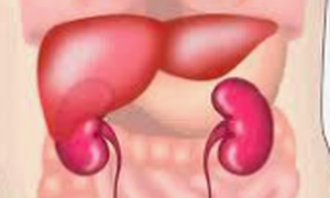 Nhận biết dấu hiệu bệnh trở nặng của xơ gan