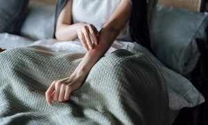 Ngứa da nhiều ban đêm cảnh giác với suy thận