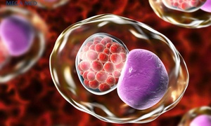 5 dấu hiệu cảnh báo nhiễm Chlamydia ở phụ nữ: Nhận biết sớm để phòng ngừa vô sinh