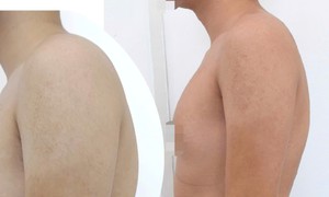 Cổ rụt, lưng gù vì ngồi học vẹo vọ, bò ra bàn