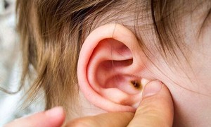 Cần làm gì khi nghi ngờ trẻ bị viêm tai giữa, cách nhận biết?